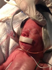 First time seeing Landon's face.